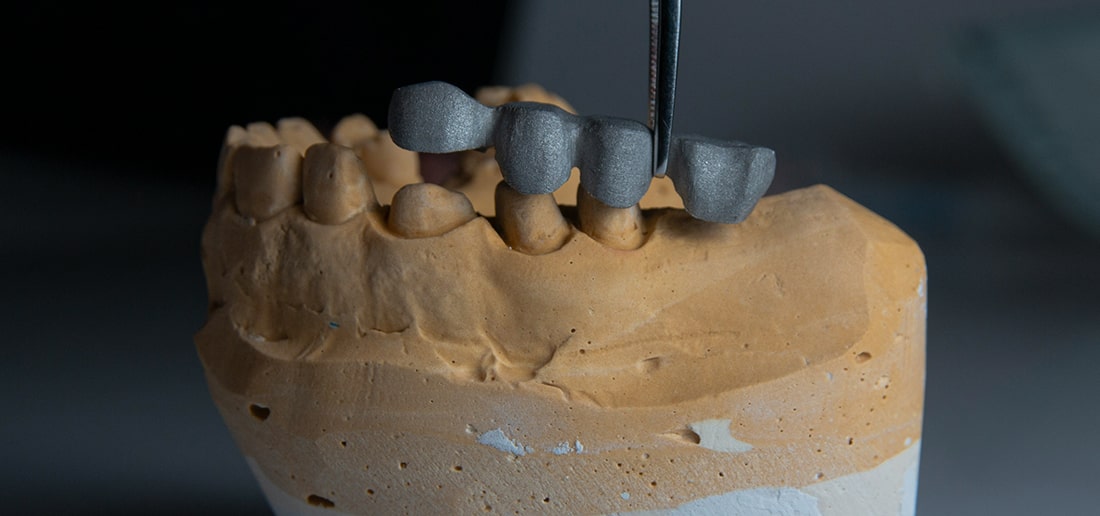 Виды съемных зубных протезов, показания и противопоказания
