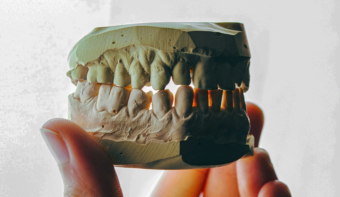 Отсутствие нижних зубов: причины и лечение