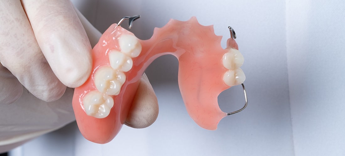 Частичный зубной протез