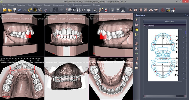 Цифровая стоматология