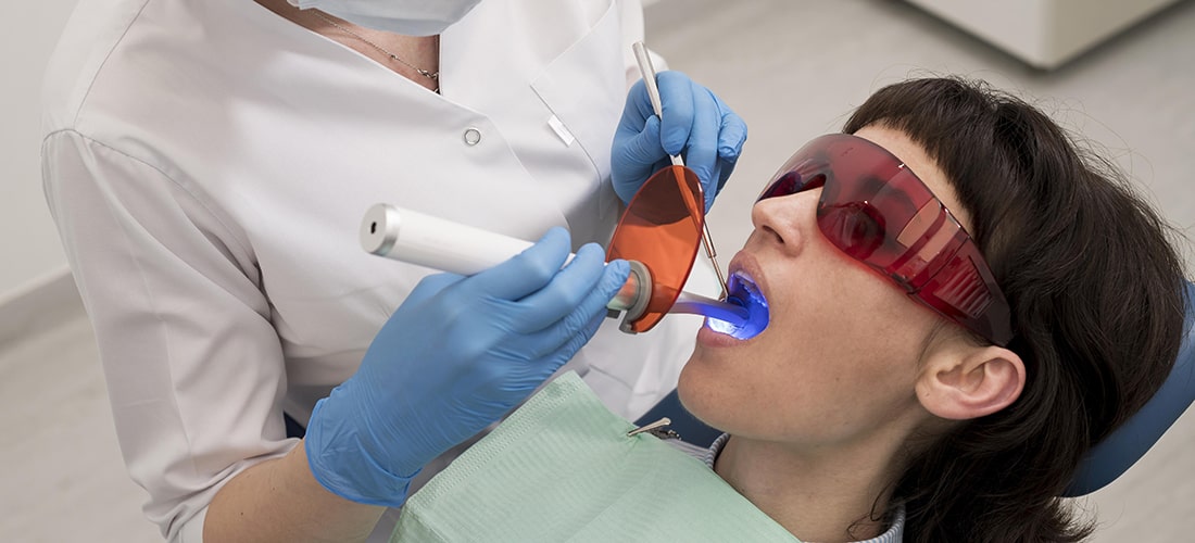 Удаление зубных отложений: пять эффективных методов